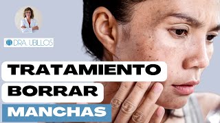 EL MEJOR TRATAMIENTO PARA BORRAR LAS MANCHAS DEL SOL [upl. by Esinyt]