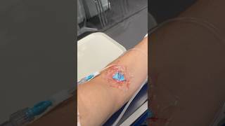 Second Inflectra infusion in 2024 infliximab canada health shorts short hospital update [upl. by Learrsi]