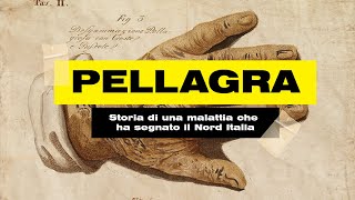 La PELLAGRA STORIA di una MALATTIA che ha SEGNATO il Nord Italia [upl. by Llerrom]