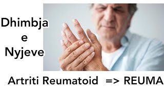 ARTRITI REUMATOID  REUMATIZMI  artritis rheumatism reuma artritireuma artritisreumatoide [upl. by Sesilu]