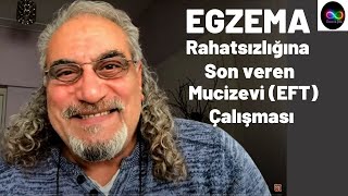 EGZEMA Rahatsızlığına Son veren Mucizevi EFT Çalışması [upl. by Yand]