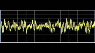 Arthritis 1 and 2  Rife Frequencies [upl. by Enidlarej]