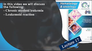 Chronic Myeloid Leukemia CML  Pathogenesis Symptoms and Treatment [upl. by Alemac]