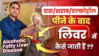 FullVideoदारूशराबएल्कोहॉल पीने के बाद वो लिवर में कैसे जाती हैं  Alcoholic Fatty Liver Disease [upl. by Atsirhc]