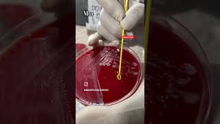 ECOLI  MICROBIOLOGY youtube youtubeshort shortsviral viralshorts trending microbiology [upl. by Bordy176]