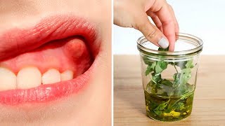 Heal Your Tooth Abscess  Dental Infection Naturally [upl. by Indnahc503]