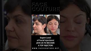 Expert Level of Facial Injections by Dr Olga Shvab [upl. by Egwan697]