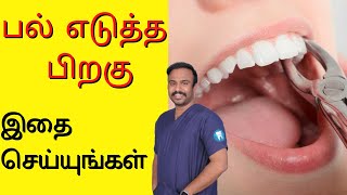 பல் எடுத்த பிறகு இதைச் செய்யுங்கள்  What to do After Tooth Removal  Tamil [upl. by Esiuol]