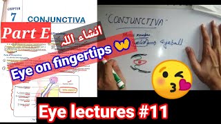 Eye lectures 11 Ptergium fibrovasular connective tissue of conjunctiva conjunctivitis eye [upl. by Nibur88]