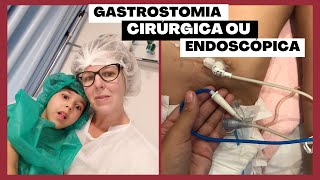 GASTROSTOMIA CIRÚRGICA OU ENDOSCÓPICA Qual forma escolher [upl. by Nohs]