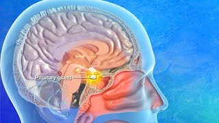 Endoscopic Transsphenoidal Pituitary Surgery Explained [upl. by Nostets]