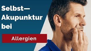 Stoppe Allergien Entdecke Akupunkturpunkte für schnelle Linderung [upl. by Ingles296]