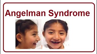 Angelman Syndrome  Key Facts amp Symptoms  2024 [upl. by Beauchamp732]