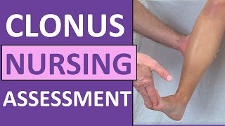 Clonus Test Positive Reflex Sign Preeclampsia Pregnancy  Nursing Skills [upl. by Anner]