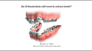 Do Orthodontists Still Need To Extract Teeth [upl. by Harman]