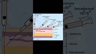 injectionintradermalintramuscularintravenoussubcutaniousBvkCollege Visalakshi Nagar [upl. by Harbed928]