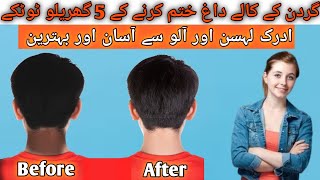 Remove neck darkness in 10 mins at homeکالی گردن کو سفید کرنے کا طریقہ 😱💯 beautytips skincare [upl. by Theurich]