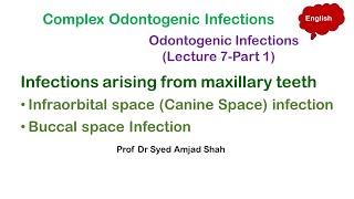 Infraorbital space  Canine Space  Buccal space Infection  Complex Odontogenic Infections [upl. by Nuavahs]