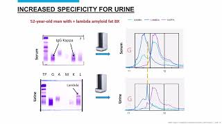 Applying MASS FIX to Urine Samples [upl. by Godwin]