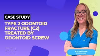 Case study 133  Type 2 odontoid fracture treated by Odontoid screw  explained by Dr Betsy Grunch [upl. by Roxanna880]