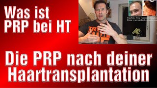 PRP Therapie Haartransplantation Erfahrung PRP nach Haarverpflanzung Mensecrets [upl. by Midian534]