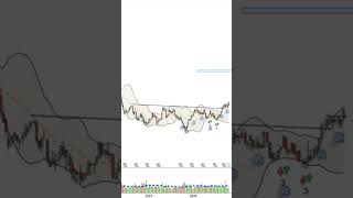 Medtronic quand neutraliser le trade bourse trading dividende [upl. by Annwahsal592]