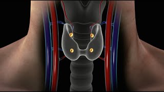 Overview of Parathyroid Disease Causes Symptoms and Treatment for Hyperparathyroidism [upl. by Annaira]