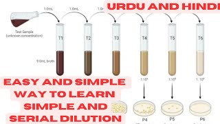 Dilutions and serial dilutions practically explained MicroPharmaTube MicrobiologyInsider [upl. by Adnale]