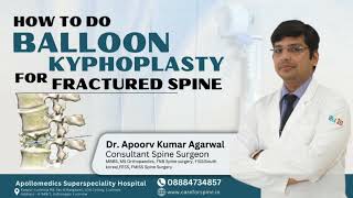 Balloon Kyphoplasty StepbyStep Guide for Spine Surgeons  Minimally Invasive Technique DrApoorv [upl. by Yelahc]