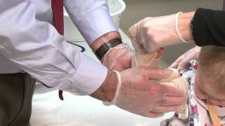 Osteogenesis Imperfecta  Long Arm and Long Leg Splint Demonstrations [upl. by Naarah]