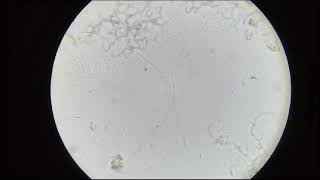 Trichomonas vaginalis pada urin perbesaran 10x parasitology trichomonasvaginalis tlm unisayogya [upl. by Jempty]