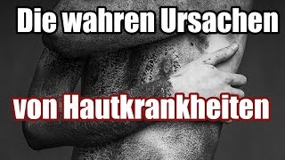 Was dir dein Arzt nicht sagt  Die wahren Ursachen von Hautkrankheiten Teil 12 [upl. by Onstad]