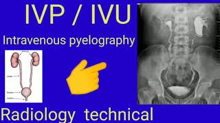 IVP  IVU  Intravenous pyelography  Radiology  Radiography  By BL kumawat [upl. by Rehpoitsirhc]