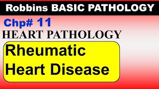 Chp11 Robbins Patho  Heart Pathology  Rhematic Heart Disease  Dr Asif Lectures [upl. by Redmund387]