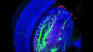 ZEISS LSM 800 with Airyscan Drosophila brain confocal 3D microscopy [upl. by Aitnyc]