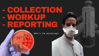 Blood Culture Test Procedure  Microbiology [upl. by Yticilef]