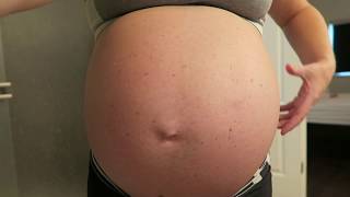 Contractions at 36 Weeks [upl. by Hach]