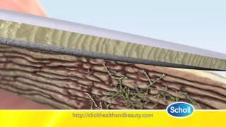 SCHOLL FUNGAL NAIL TREATMENT [upl. by Darla]