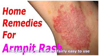 Ten ways to eliminate armpit rash  what health tips [upl. by Leiad]