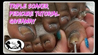 Pedicure Tutorial Excessive Buildup Removal Toenail Cleaning 😎 [upl. by Heber]