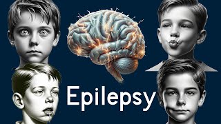 Epilepsy in Children  Simply Explained [upl. by Htebazle]