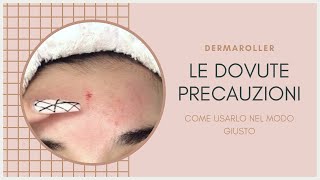 DERMAROLLER E MICRONEEDLING  COME USARLO IN CASA SENZA PROBLEMI [upl. by Yuhas]