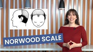 What Is the Norwood Scale How to Understand the Different Stages of Balding  Lordhair [upl. by Enomrej]