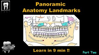 Panoramic Radiography landmarkOrthopantomogramOPGAnatomical LandmarkDental ExamDental Radiology [upl. by Azarria301]