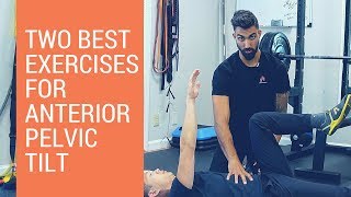 Anterior pelvic tilt correction the 2 best beginner exercises [upl. by Nulubez]