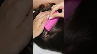 ASMR Relaxing LICE Check Removal and TREATMENT Real Person shorts short asmr [upl. by Valerie923]