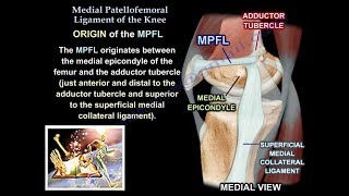 Medial Patellofemoral Ligament Of The Knee Anatomy Everything You Need To Know  Dr Nabil Ebraheim [upl. by Ecidnarb206]