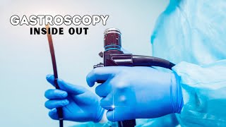 Gastrscopy Inside Out  Upper Endoscopy  Why and How Gastroscopy is done [upl. by Jamila]