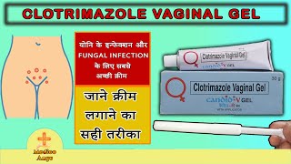 Clotrimazole vaginal cream uses in hindi  Candid v gel  candid v gel how to apply [upl. by Korman]