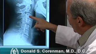 How to Read Xrays of the Cervical Spine Neck  Colorado Spine Expert [upl. by Ailbert150]